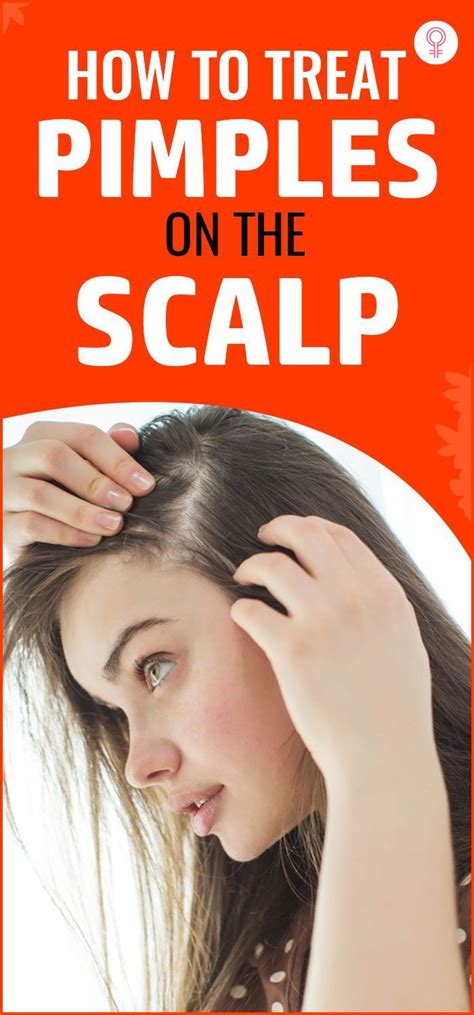The Best Ways To Deal With Pimples On Your Scalp How To Treat Pimples