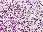 Premium Photo | Microscopic view of gram stain showing rod shape ...