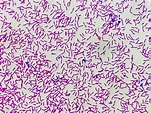 Premium Photo | Microscopic view of gram stain showing rod shape ...