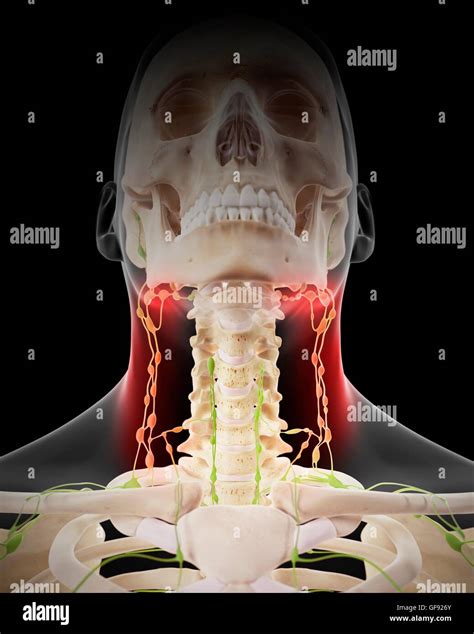 Painful Human Lymph Nodes Illustration Stock Photo Alamy
