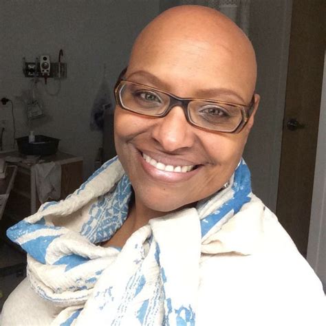 everyday for alopeciaawarenessmonth we are going to recognize one alopecianbeauty for her