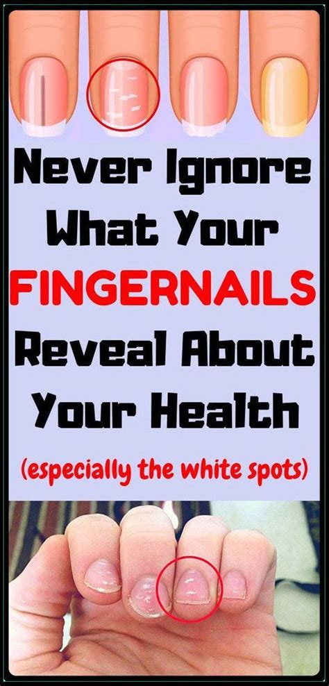 Cool What Does Painting Your Fingernails White Mean Ideas Fsabd42