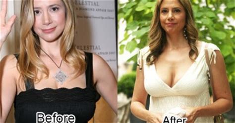 Alyssa Milano Plastic Surgery Before And After Boob Job Photos