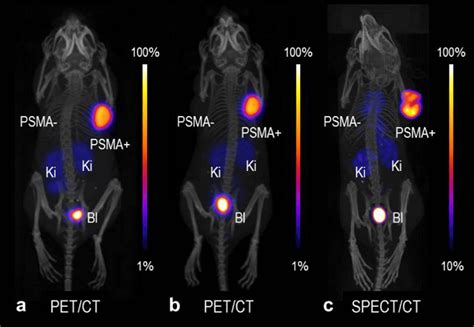 Petct And Spectct Images As Mips Of Mice 2 H After Injection Of A