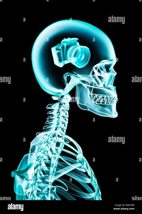 X Ray Photographic Memory 3d Illustration Of Human Skeleton X Ray