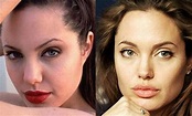 Angelina Jolie Before and After Plastic Surgery – The Retelling of her ...