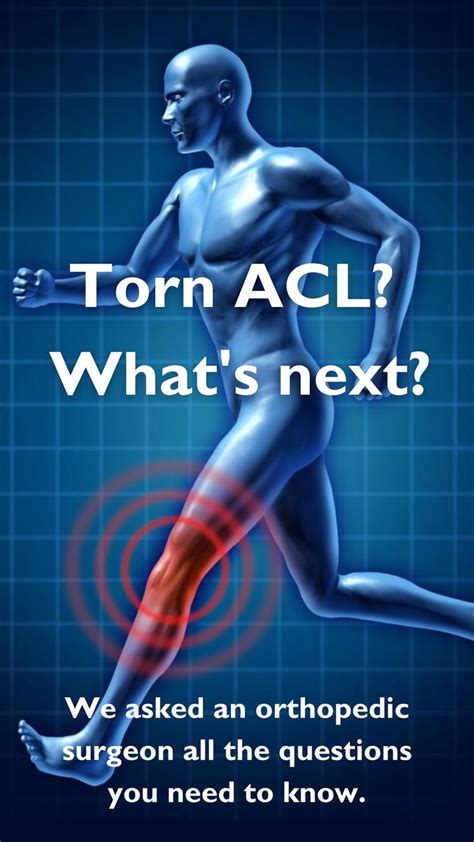 Ask An Orthopedic Surgeon Acl Tears And Reconstruction Acl Tear Acl