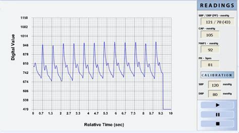 Central Aortic Systolic Pressure Casp Peter Yan Cardiology Clinic