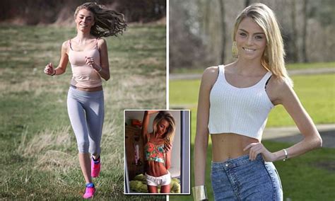 From Anorexic Teen To Beauty Queen Girl Who Lived On Just One Apple A