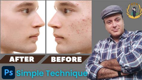 Get Flawless Skin In Seconds Photoshop Face Cleaning Photoshop