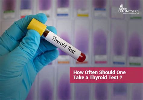 How Often Should You Get A Thyroid Blood Test