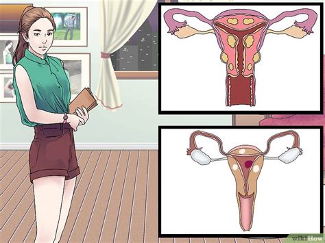 How To Treat Vaginal Cysts