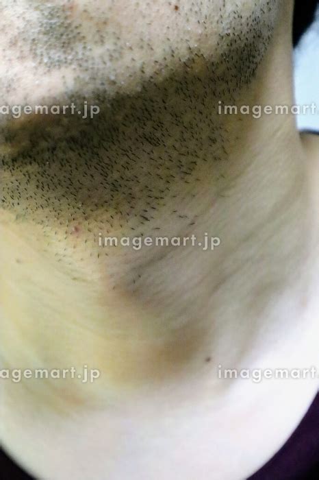 無精ひげを生やした日本人男性のクローズアップの写真素材 184036563 イメージマート
