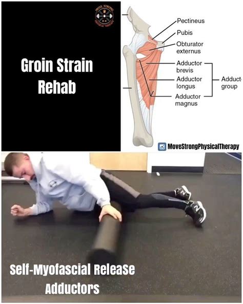 Move Strong Physical Therapy On Instagram “groin Strain Rehab Groin Or