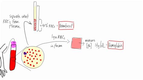 Anemia Basic Lab Tests Hematocrit Hemoglobin Reticulocyte Mcv