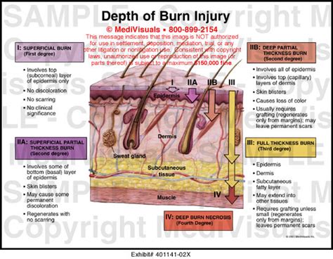 Depth Of Burn Injury Medical Exhibit Medivisuals