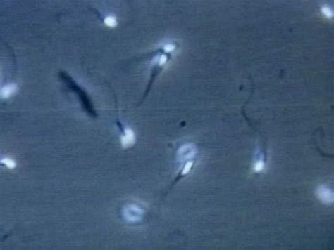 Woman Raises 15000 To Extract Dead Fiances Sperm