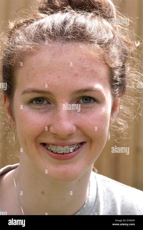 Portrait Of Teenage Girl With Braces Smiling Stock Photo Alamy