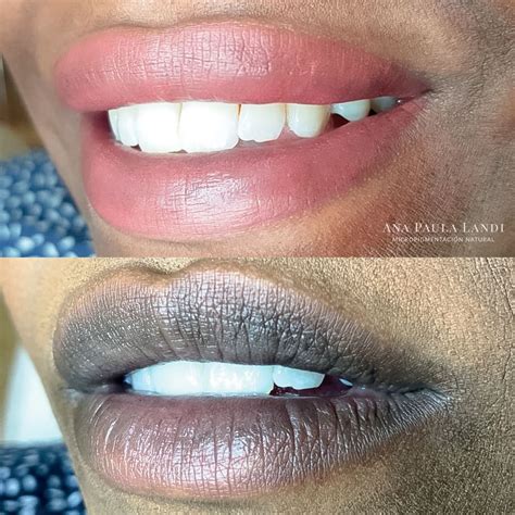 Stages Of Lip Procedure Seamless Airbrushed Part Lip Blend Not A Lipstick Look Just