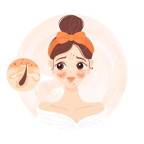 Free Vector Cartoon Oily Skin Illustration With Woman