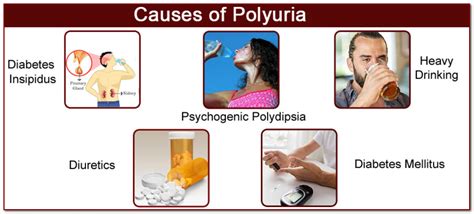 Your genes might cause this type of diabetes. 3 P's of Diabetes (Polyuria, Polyphagia, Polydipsia ...