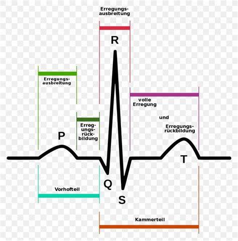 Electrocardiography Heart Arrhythmia Signal Processing Atrial