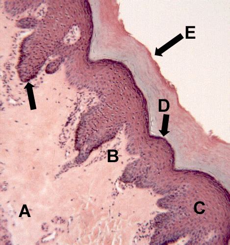 Stratified Squamous Epithelium Found In Skin Keratinized Stomach
