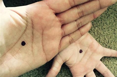 Maybe you would like to learn more about one of these? The Black Dot Campaign - goodtoknow