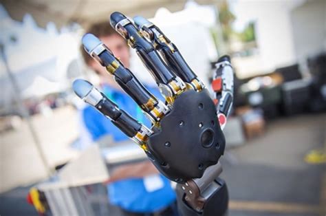 Atom Limbs Is Bringing A Mind Controlled Prosthetic Arm To Market