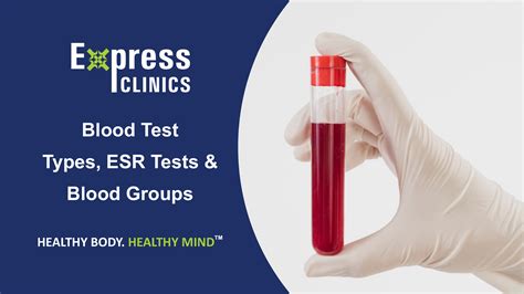 Gribbles pathology taiping is a pathology lab based in taiping, perak. Blood Test - Types, ESR Tests & Blood Groups. - Express ...