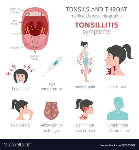 Tonsils And Throat Diseases Tonsillitis Symptoms Vector Image