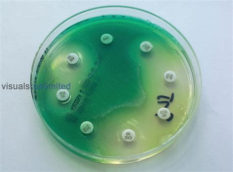 Culture Of Pseudomonas Aeroginosa Bacteria On An Antibiogram With