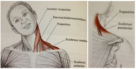 Striated Shoulderneck Muscles In Humans If You Know Where Muscles