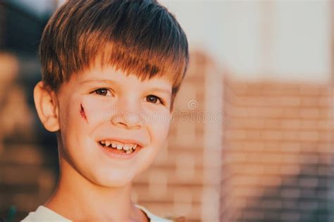 Portrait Of A Smiling Boy With A Bruise On His Face Stock Photo Image