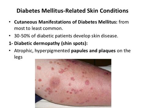 Dermatology 5th Year 3rd Lecture Dr Faraedon Kaftan