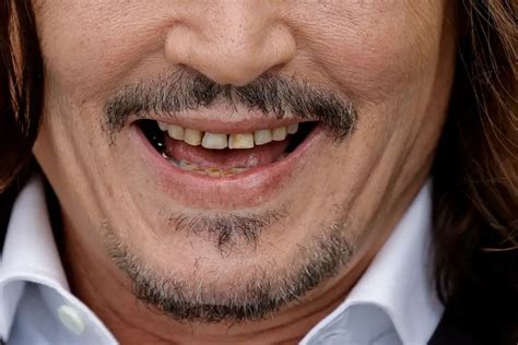 Johnny Depp Causa Asco Y Repugnancia Tras Aparecer Con Los Dientes