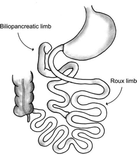 Anatomy Of The Duodenojejunal Bypass Djb The Duodenum Is Divided