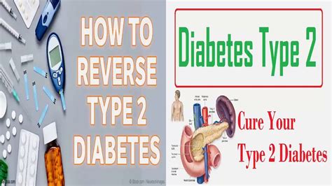 Sample Diet For Type 2 Diabetes The Guide Ways