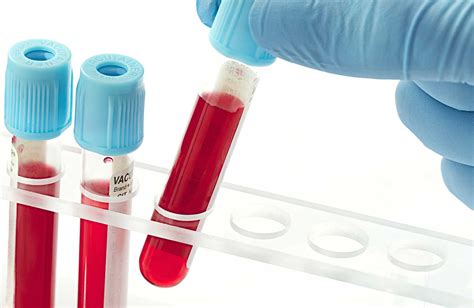 Abo Blood Type Discovery