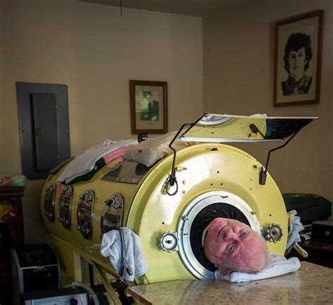 Living Inside A Canister Dallas Polio Survivor Is One Of Few People Left In U S Using Iron Lung