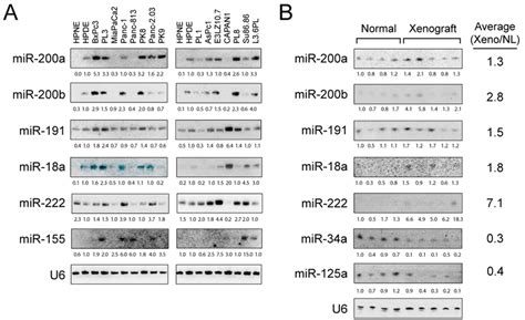 Validation Of Dysregulated Mirna Expression In Pdac Cell Lines And