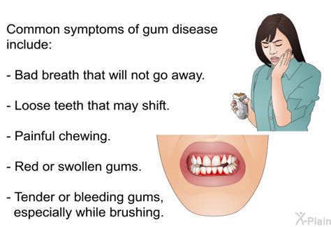 Patedu Com Gum Disease