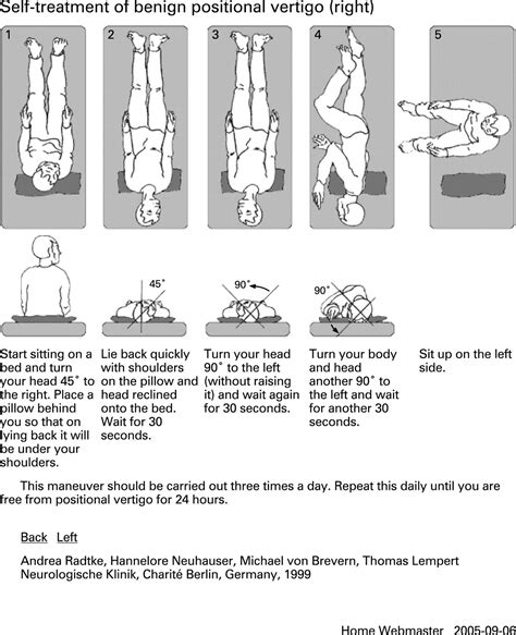 Epley Manöver Links Pdf Epley Liberatory Manoeuvre For Bppv The