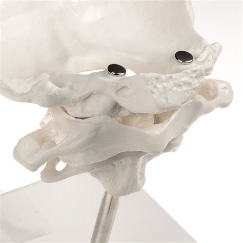Anatomical Model Atlas And Axis With Occipital Plate