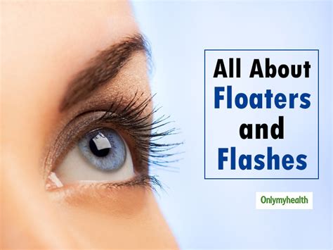 Floaters And Flashes In The Eyes Causes And Treatment Onlymyhealth