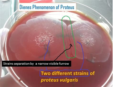 Swarming Growth Of Proteus On Blood Agar Archives Medical Notes