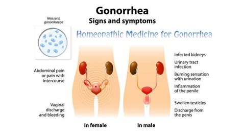 Homeopathic Remedy Vaginal Pain Whorey