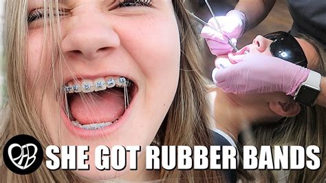 She Got Rubber Bands Getting Rubber Bands For My Braces Braces Vlog Update Youtube