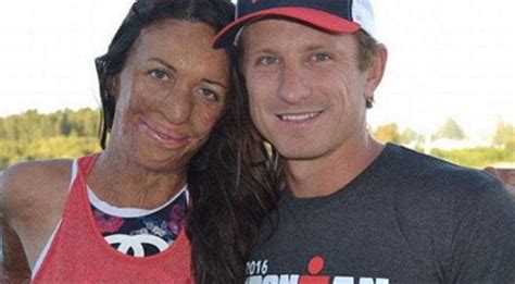 Inspiring Burns Survivor Turia Pitt Finishes Ironman Triathlon In Hours After Being Told She