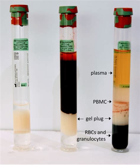Isolation Of Pbmcs Using Vacutainer Cellular Preparation Tubes Cpttm